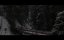   / Off Piste - 