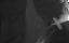  / Dawn - 