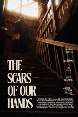     / The Scars of Our Hands