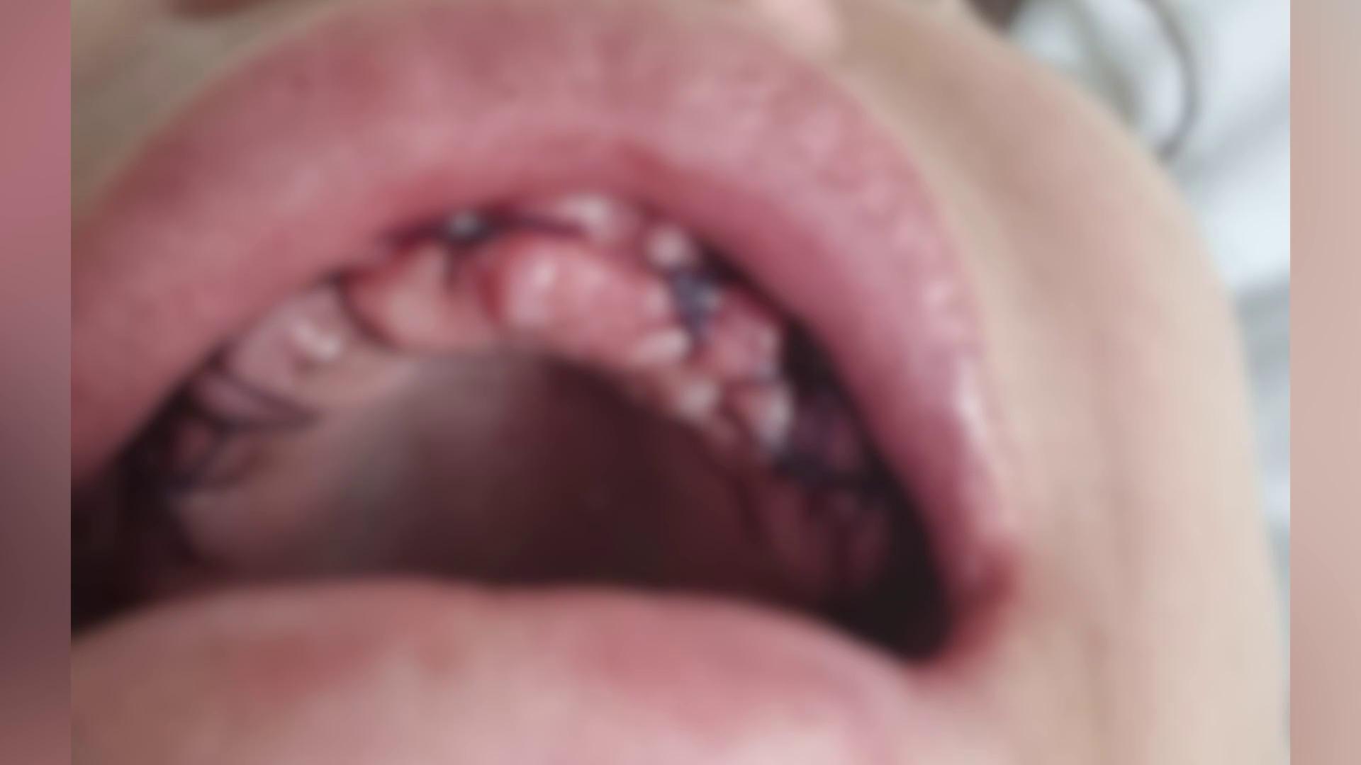 ������