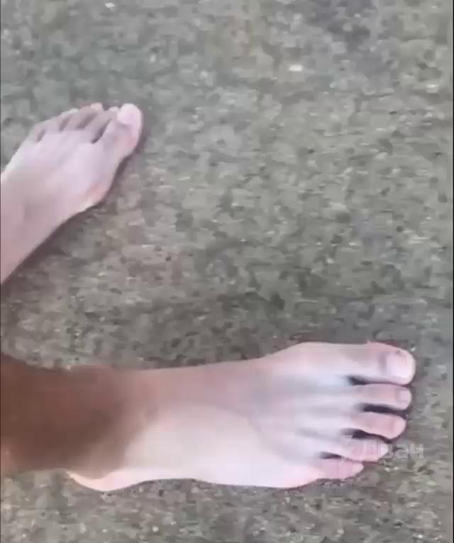 ������