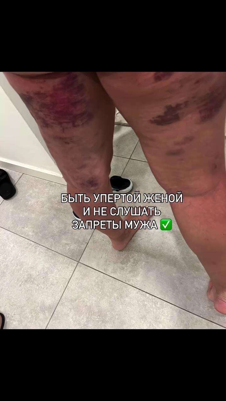 ������
