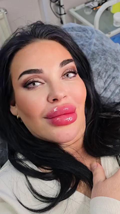 ������