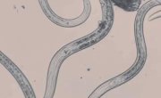 NAILS UNDER MICROSCOPE